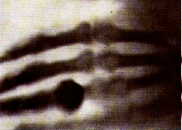 Snmek ruky pan Rntgenov ze 22.12.1895 Prvn rentgenov snmek